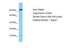 S100Z Rabbit anti-Human, Polyclonal, Novus Biologicals 0.1ml; Unconjugated:Antibodies,